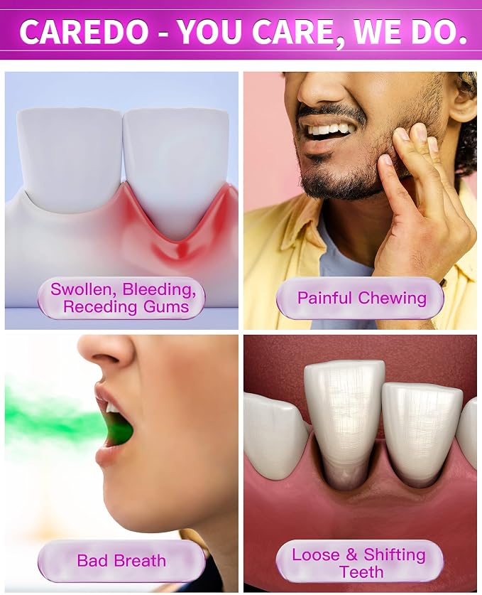 CAREDO Gum Toothpaste for Periodontitis, Gum Repair for Receding Gums, Gum Disease & Gingivitis Treatment, Periodontal Disease Treatment for Gum Health, Gum Disease Repair Bad Breath Toothpaste 2 Pack