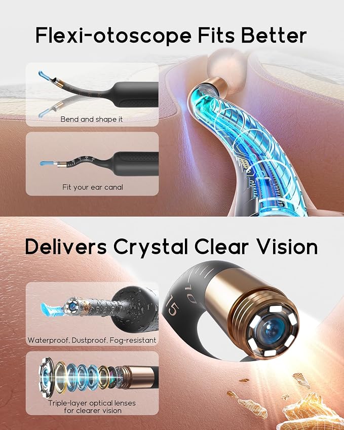 Bebird Earsight Plus R37R Ear Wax Removal Tool Camera, FSA HSA Eligible Items, Smart Ear Cleaner with Painless Visual Tweezers, Flexible Ear Camera Otoscope, Home ENT Cleaning Kit for Family,Black