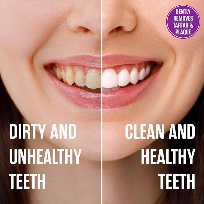 SprinJene Natural Fluoride Free Toothpaste for Sensitive Teeth & Gums (Lead-Free) – Patented Toothpaste with Black Seed Oil & Zinc – Dry Mouth Prevention for Fresh Breath – Made in the USA (2 Pack)
