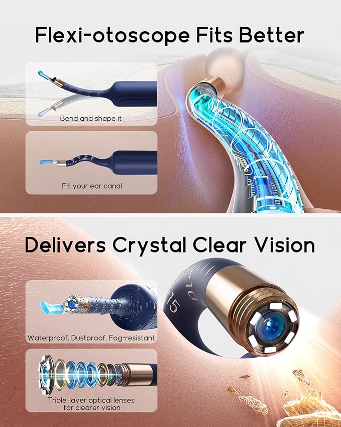 Bebird Earsight Plus R37R Ear Wax Removal Tool Camera, FSA HSA Eligible Items, Smart Ear Cleaner with Painless Visual Tweezers, Flexible Ear Camera Otoscope, Home ENT Cleaning Kit for Family,Blue