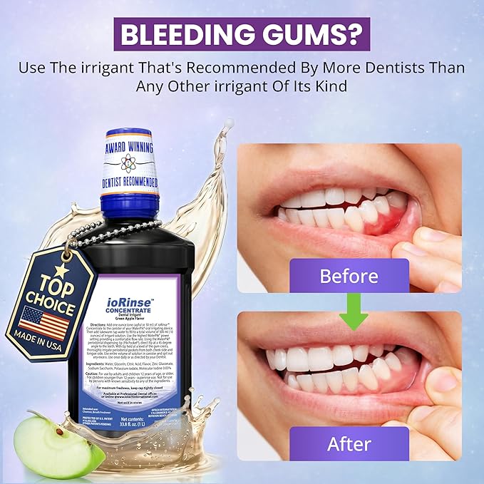 ioRinse Concentrated Irrigant with Active Molecular Iodine, Alcohol-Free Dental Irrigant, for use with Waterpik Water Flossers, and All Other Oral Irrigation Devices
