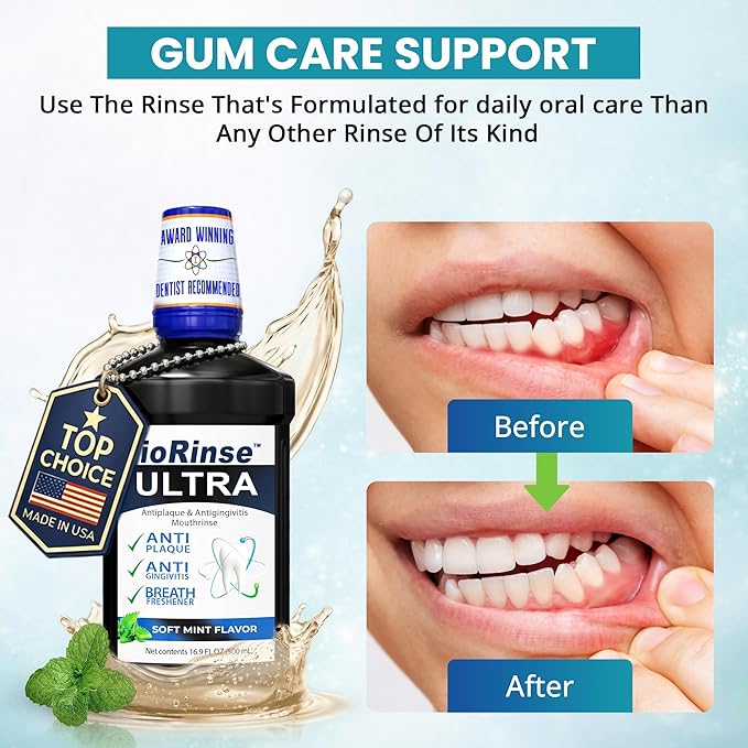 ioRinse Ultra Mouthwash is the Choice of 1,000s of Dentists as the Mouth Wash for Adults and Kids Oral Care and Hygiene. It's an Alcohol Free, Bad Breath Treatment and Gum mouthwash with Xylitol.