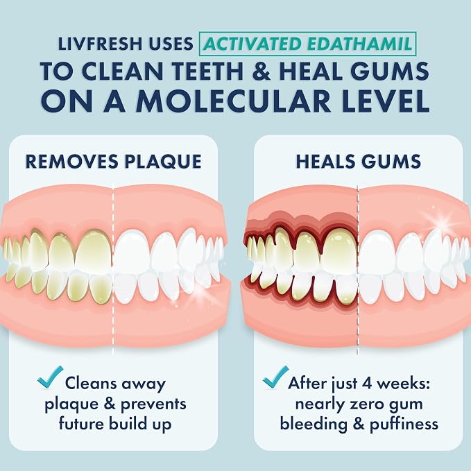 LIVFRESH Toothpaste Gel, Clinically Proven to Remove Plaque 250% Better, Improves Gum Health 190% Better, Prevents & Reduces Tartar, Freshens Breath, SLS Free Dental Gel, Peppermint, 2 Pack
