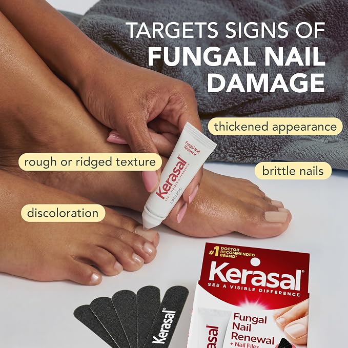 Kerasal Nail Renewal, Restores Appearance of Discolored or Damaged Nails, 0.33 fl oz (Packaging May Vary)